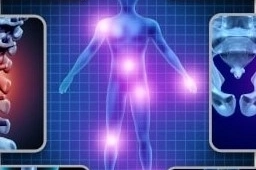 Fibromyalgie